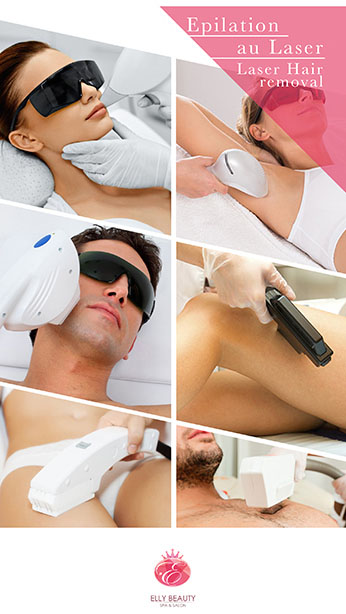 Face tightening- Laser 